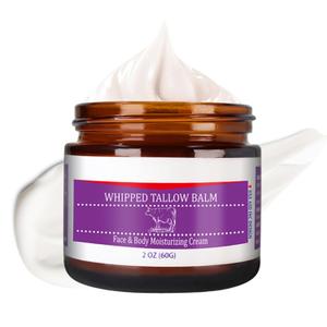 Handmade Whipped Tallow Cream - Whipped Tallow Balm - Beef Tallow for Skin - Lotion for Extremely Dry Skin - Body Cream for Women - Beef Tallow Moisturizer - Beef Tallow for Face & Body Exp 9/14/27
