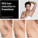 Braun IPL, SilkExpert Pro 5, IPL Hair Removal for Women and Men, Permanent Laser Hair Reduction At-Home, 1 Head, IPL5100