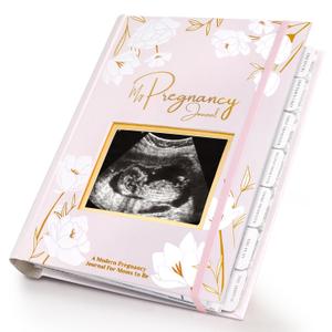Pregnancy Journal, Pregnancy Announcements - 80 Pages Hard Cover Baby Books For Mom To Be Gift, Baby Memory Book Keepsake, Gender Reveal Gifts For New Moms, Shower & Registry (Blush)