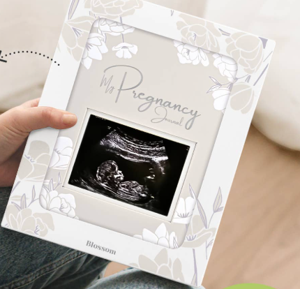 Pregnancy Journal, Pregnancy Announcements - 80 Pages Hard Cover Baby Books For Mom To Be Gift, Baby Memory Book Keepsake, Gender Reveal Gifts For New Moms, Shower & Registry (Clay)