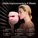 INIA Glow 4D Wireless Red Light Therapy Mask for face Dual NIR, 320 LEDs, 4 Modes, Under-Eye Cooling, Cordless & Rechargeable LED Face Mask for Home & Travel, Skincare Gifts for Women Mom Wife, Pink