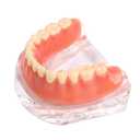 Dental Model Overdenture Transparent Lower Jaw Dental Implants Model Detachable Model Lower Jaw Dental Teaching Model Suitable for Education and Study Silver