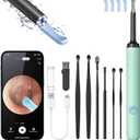 Ear Wax Removal Tool Camera - Ear Cleaner with 1080P HD Camera, Otoscope with Light, Earwax Removal Kit for iPhone, iPad, Android Phones (Green)