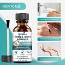 Wart Remover Liquid with Salicylic Acid for Wart Removal & Corn Care, Targeted Application, 1.01 Fl Oz