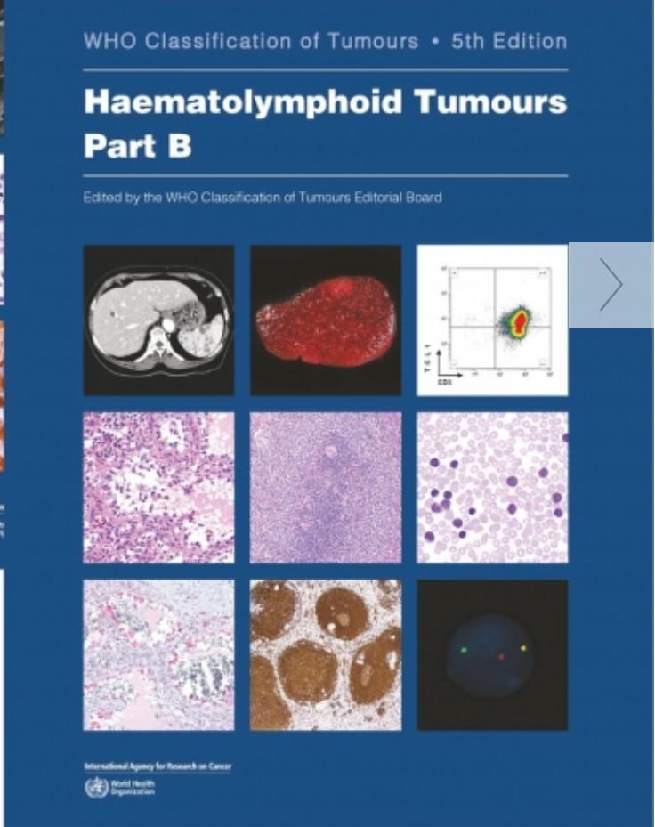 WHO Classification of Tumours: Haematolymphoid Tumours, 5th Edition (PART B)