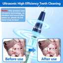 Ni-SHEN Dog Plaque Remover for Teeth,Pet Ultrasonic Tooth Cleaner,Teeth Cleaning Kit -Tartar Remover for Teeth Stains for Dogs and Cats (Blue)