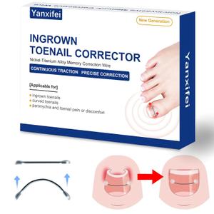 Nitinol Ingrown Toenail Corrector,at Home Ingrown Toenail Treatment,Curved Toenail Straightener,Ingrown Toe Nail ReliefIngrown Toenail Removal Kit (1/2 In,11/16 In)