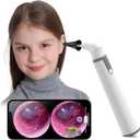 ScopeAround Otoscope with Light, Ear Camera with Dual View, 720pHD WiFi Ear Scope with 6 LED Lights, 3.9mm Lens Otoscope Camera for Kids and Adults, Ear Scope Compatible w/Android and iPhone