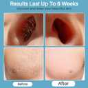 BLITZWAX Back and Nose Waxing Kit for Men, Hard Wax Warmer for Brazilian, Body and Face, At Home Hair Removal Kit, Beginner Friendly, Quick Heating, 93 Accessories, Royal Blue