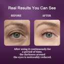 Calcium Dark Spot Eye Cream 2 Pack | Anti-Aging Eye Cream for Dark Circles, Sagging and Elasticity