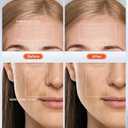 NEWKEY 4D LED Red Face Mask Light Therapy Women MOM wife GIFT, 630nm Red Light Therapy for Face Wrinkle, 465nm Blue Light Therapy Mask for Acne, Real 150LEDs,450 LED Chips, 10 Min auto Off,Plug in