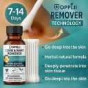 Wart Remover Liquid with Salicylic Acid for Wart Removal & Corn Care, Targeted Application, 1.01 Fl Oz