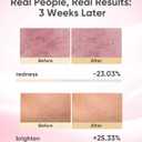 SDKWDH LED Light Therapy Mask, Red Light Therapy for Face - Red Light for Anti-Aging & Wrinkles, Blue for Acne, IR for Deep Repair, At-Home Device, FDA Cleared, Portable & Rechargeable, Pink