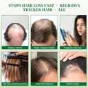 Batana Oil Shampoo, Hair Growth Shampoo for Thinning Hair & Hair Loss Treatment - Organic Rosemary, Formula with Biotin & Keratin to Reduce Shedding, Thicken Hair For Men & Women10.1oz