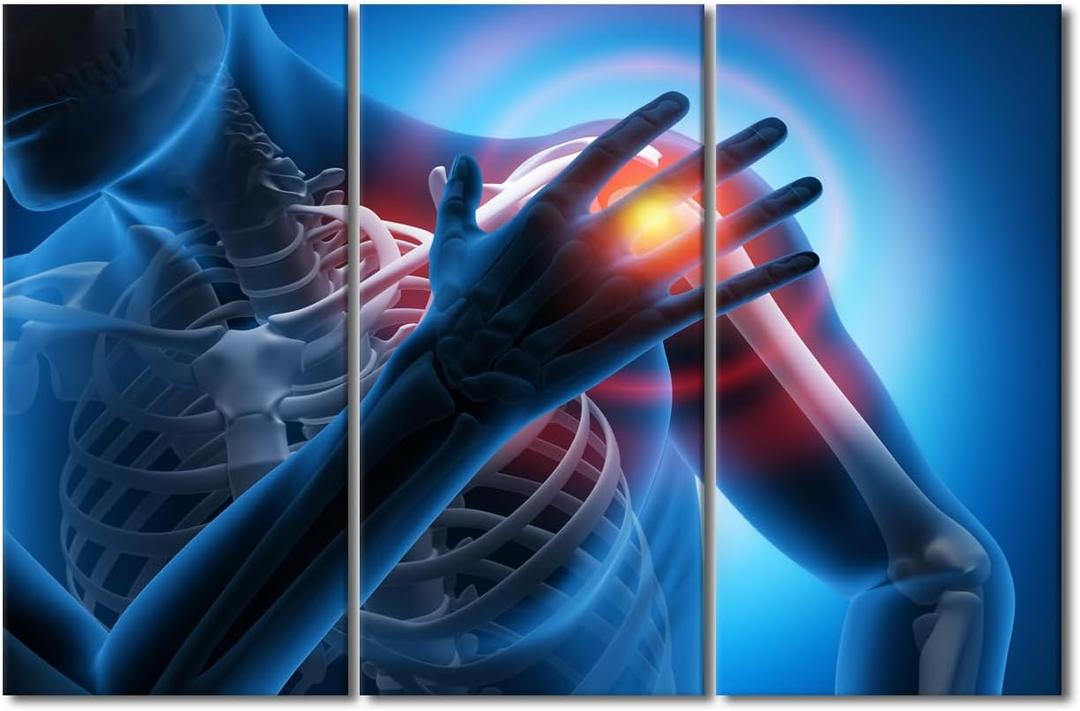 Contemporary Wall Decor Human Shoulder Pain Skeleton X-Ray Pictures Artwork Wall Art for Living Room 3 Piece Medical Health Care Concept Poster Modern Artwork Painting Framed Ready to Hang 40"Wx60"H