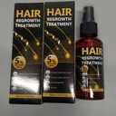 5% Minoxidil for Men & Women, Advanced Formula Hair Regrowth Spray and Topical Solution for Thinning Hair and Beard Exp: 12-09-28