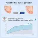 Awojrsky Bunion Corrector for Women Big Toe Straightener Bunion Corrector for Men, Relief splints Reduce Pain and Correct Toe Alignment, Brace Day/Night, fit for R/L,Washable(Black)