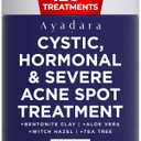 Cystic Acne Spot Treatment, Overnight Hormonal Cystic Acne Treatment for Face, Women, Men and Teens, Cystic Hormonal Acne Treatment for Body, Pimple Cream, Sulfur Acne Spot Treatment, 120 Uses