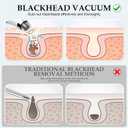 Facial Pore Blackhead Remover Vacuum - Fore Cleaner and Blackhead Extractor with 3 Adjustable Suction Levels - 5 Probes - Pore Vacuum Kit for Women&Men (White)