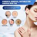Wart Removal Cream 20g, Effective Treatment of Warts, Corns Spot Moles, Moles and Calluses, Wart Remover Cream for Body and Hands