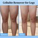 Hefnoya Anti Cellulite Massage Roller, Muscle Massager Cellulite Remover for Leg, Waist, Back, Arm, Calf, Buttocks, Lymphatic Drainage Massager, Fascia Massager Body Sculpting Fats Remover Tool