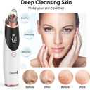 Blackhead Remover Pore Vacuum for Face and Nose, Facial Pore Cleanser with 3 Suction Levels, 5 Replaceable Tips, USB Rechargeable Tool for Blackheads and WhiteheadsWhite