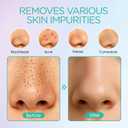 VOYOR Blackhead Remover Pore Vacuum - Electric Face Vacuum Pore Cleaner Acne White Heads Removal with 6 Suction Heads (BR410)