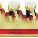 Dental Periodontal Disease assort Tooth Teeth Typodont Study Teaching Model New