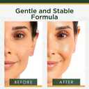 Moisturizer, Hydrating, Anti-Aging, Reduces Dark Spots & Fine Lines, Brightens, Firmer and Smoother Skin Non Greasy - Vitamin C 1.7 Fl Oz