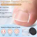 Ingrown Toenail Corrector Set with Breathable Ingrown Toenail Strips Curved Toenails Corrector Patch, File and Lifter Professional Pedicure Tools for Women and Man