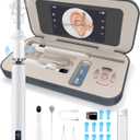 Sofbunny A03 Ear Wax Removal Tool Camera with Screen, Ear Cleaner with 1080P HD Camera, 3 in 1 Ear Cleaning Tool with 10 Replacement Tips,Earwax Remover Kit for Kids & Adults,Otoscope with LED Lights