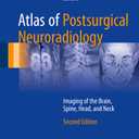 Atlas of Postsurgical Neuroradiology: Imaging of the Brain, Spine, Head, and Neck