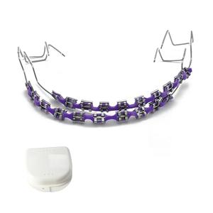 1-Set Temporary Tooth Decoration with Metal Wires, Metal Brackets and Orthodontic Ligature Ties, Ideal for Orthodontists to Explain and Dental Students to Practice (Purple)