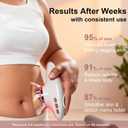 CXGRISE Body Sculpting Machine, 4 in 1 Cellulite Remover for Legs, Adjustable Cellulite Massage Tool, Home Use Cupping Therapy Tool for Belly, Waist, Arms, Legs and Face (Beige)