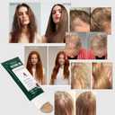 Batana Oil for Hair Growth  100% Pure Organic & Raw Batana  Promotes Thicker, Stronger Hair, Helps Prevent Hair Loss  Natural for Men & Women  7.76 oz