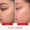 First Aid Beauty Daily Facial Treatment Pads, AHA Exfoliating, Hydrating Barrier Support & Salicylic Acid Acne Pads, Sensitive Skin Safe
