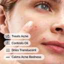 2 x The Ordinary Sulfur 10% Powder-to-Cream Acne Spot Treatment Concentrate, Reduces Pimple Size and Zit Redness, 0.18 Oz