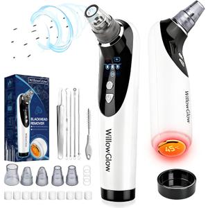 Heated Pore Vacuum, Blackhead Remover with Strong 3-Level Suction, 5 Nozzles for Deep Cleaning Face, Nose & Sensitive Skin, Professional Pore Extractor & Facial Kit