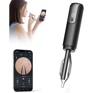 Blackhead Removal Tweezer with 1080p Camera, Ultimate Precision: Blackhead Removal with Camera - Perfect for Delicate Tasks! - - Ingrown Hair, Ear Hair Tweezer (Black)