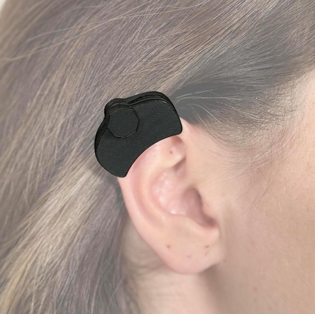 Keloid Compression Earring Clinically Designed Medical Pressure Helix Earlobe for Ear Keloid Removal, Post-Surgery Healing & Scar Wound Treatment
