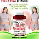 Keto ACV Gummies Advanced Weight Loss - ACV Keto Gummies for Weight Loss for Women and Men - Keto Gummies Supplement - Detox & Cleanse, Digestion - Apple Cider Vinegar - Apple Flavor Exp 7/2/27