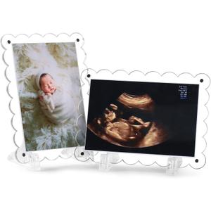 Sonogram Picture Frame Dual, Magnetic Ultrasound Frame with Stand - 2 Pack Clear Acrylic Scalloped Edge for Pregnancy Announcement, Baby Shower Gifts
