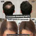 IMPERIO Hair Building Fibers for Thinning Hair - 26g Premium Hair Fibers for Women & Men - Dark Brown