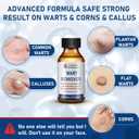 SKAYAH Wart Remover Freeze Off - Professional Strength Wart Remover Liquid - 5% Salicylic Acid Fast-Acting Treatment for Plantar Wart,Flat Wart, Corn and Callus Remover, 15ml (0.5 fl oz)-H236