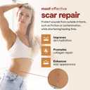 2 x AllSett Health Silicone Sheets for Scars, Post Surgery, Tummy Tuck, C-Section Recovery, Keloid Bump Removal, Stretch Marks Removal (6 Inch x 1.6 Inch), Pack of 6