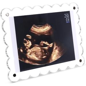 Magnetic Clear Acrylic Scalloped Baby Ultrasound Picture Frame - Sonogram Frame for Refrigerator, Display for Pregnancy Announcement, Gender Reveal & Expecting Parents Gifts(No Stand)