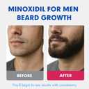 Fytikal 5% Minoxidil for Men Hair Regrowth Treatment, Extra Strength Topical Solution for Thinning Hair & Balding, Beard Growth Enhancer, Non-Greasy Fast-Absorbing Formula, 3-Month Supply