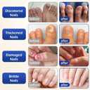 3 x Multi-Purpose Nail Repair, Nail Solution with Tea Tree Oil for Discolored and Damaged Nails，Plant Drops for Nails Care，Discolored and Damaged Nails(1PC) ﻿