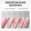 3 x CHUCHU Nail Growth and Strengthener Oil for Cuticle - Repair Moisturizing Treatment - Natural Jojoba Vitamin B & E Nail Oil for Dry Cracked Nails (Aloe Vera)
