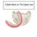 Dental Model Overdenture Inferior 2 Implants Demo Mandibular Model for Education and Study(Upper Jaw)